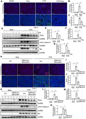 Pharmacological and Genetic Inhibition of HDAC4 Alleviates Renal Injury and Fibrosis in Mice